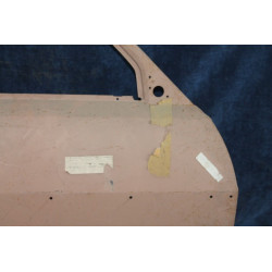 BETA  ( ? )   PELLE PORTA ANTERIORE DX   82359001
